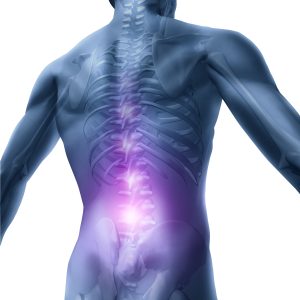 Cómo aliviar el dolor de espalda y recuperar tu bienestar