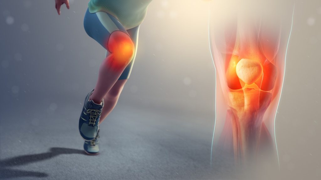 Ejercicios para tratar la tendinopatía rotuliana en fisioterapia.